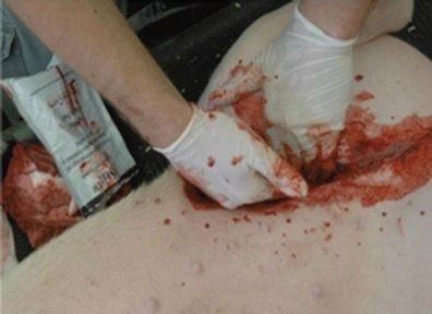 Trauma-Trainings-PETA-250